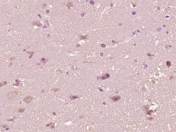 Phospho-EGFR (Ser1045) Rabbit Polyclonal Antibody