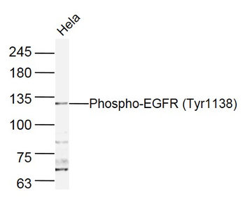 Phospho-EGFR (Tyr1138) Rabbit Polyclonal Antibody