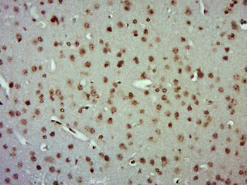 ERK1 + ERK2 Rabbit Polyclonal Antibody
