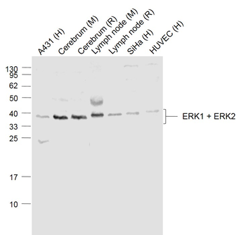 ERK1 + ERK2 Rabbit Polyclonal Antibody
