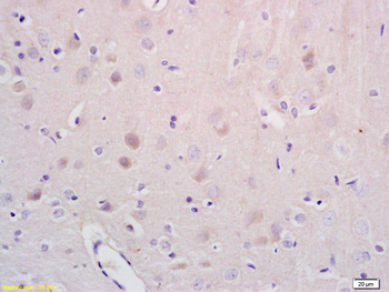 NR1D1 Rabbit Polyclonal Antibody
