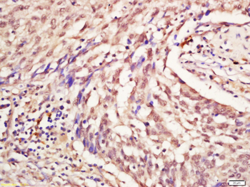 Phospho-NR1D1 (Ser55 + Ser59) Rabbit Polyclonal Antibody