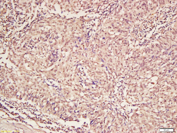 Phospho-NR1D1 (Ser55 + Ser59) Rabbit Polyclonal Antibody