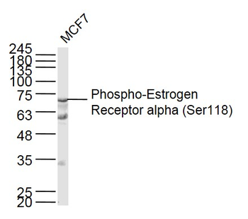 Phospho-Estrogen Receptor alpha (Ser118) Rabbit Polyclonal Antibody