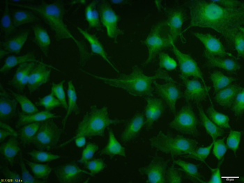 Phospho-Estrogen Receptor alpha (Ser118) Rabbit Polyclonal Antibody