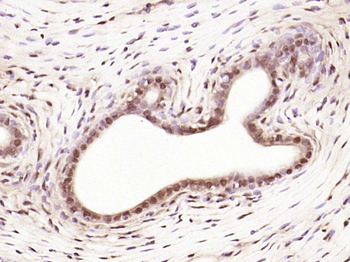 Phospho-Estrogen Receptor alpha (Ser118) Rabbit Polyclonal Antibody