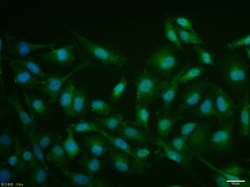 Phospho-Estrogen Receptor alpha (Ser104 + Ser106) Rabbit Polyclonal Antibody