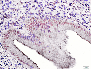 Phospho-Estrogen Receptor alpha (Ser104 + Ser106) Rabbit Polyclonal Antibody