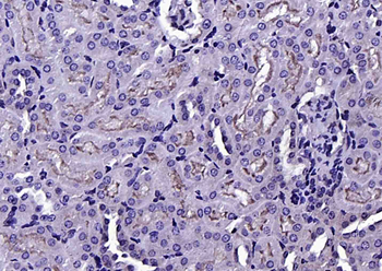 Phospho-Ezrin (Thr567) Rabbit Polyclonal Antibody