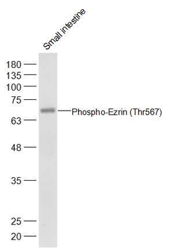 Phospho-Ezrin (Thr567) Rabbit Polyclonal Antibody