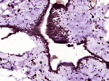 FABP4 Rabbit Polyclonal Antibody