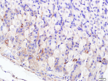 FABP5 Rabbit Polyclonal Antibody