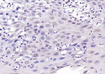 Phospho-FLG (Tyr766) Rabbit Polyclonal Antibody