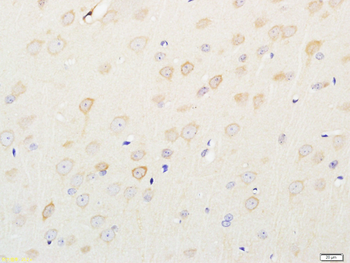 Phospho-FLG (Tyr766) Rabbit Polyclonal Antibody