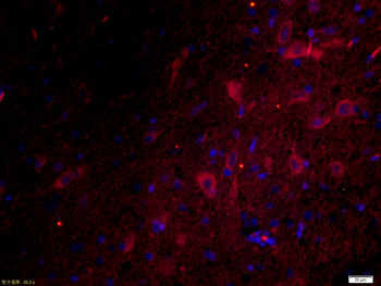 Phospho-FLG (Tyr766) Rabbit Polyclonal Antibody