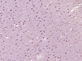 PYK2 Rabbit Polyclonal Antibody