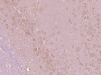 PYK2 Rabbit Polyclonal Antibody