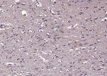 Phospho-PYK2 (Tyr402) Rabbit Polyclonal Antibody