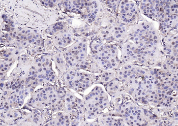 Phospho-PYK2 (Tyr402) Rabbit Polyclonal Antibody