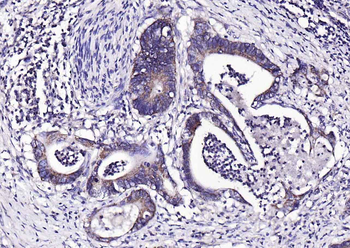 Phospho-PYK2 (Tyr402) Rabbit Polyclonal Antibody