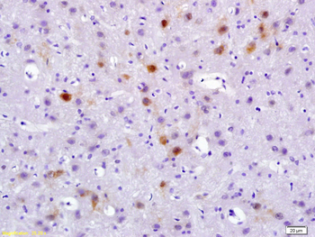 Phospho-PYK2 (Tyr402) Rabbit Polyclonal Antibody