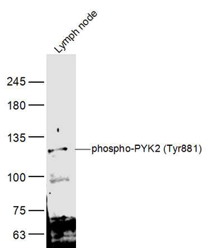 Phospho-PYK2 (Tyr881) Rabbit Polyclonal Antibody