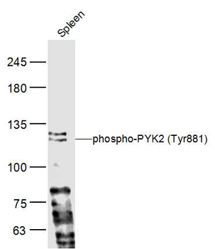 Phospho-PYK2 (Tyr881) Rabbit Polyclonal Antibody