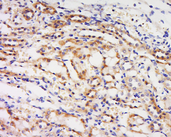 Phospho-PYK2 (Tyr881) Rabbit Polyclonal Antibody