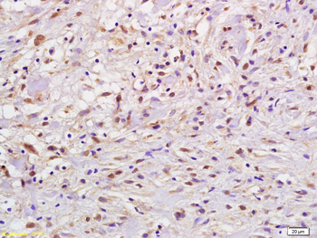 Phospho-FANCD2 (Ser222) Rabbit Polyclonal Antibody