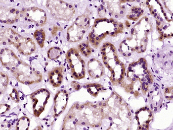 CRK Rabbit Polyclonal Antibody