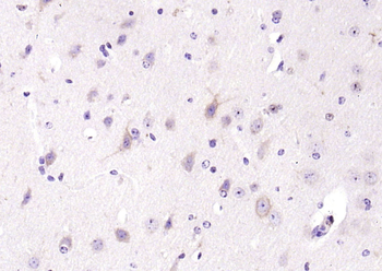 Phospho-PLCG1 (Tyr771) Rabbit Polyclonal Antibody