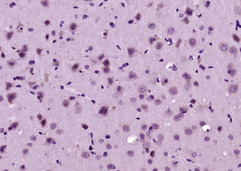 Phospho-PLCG1 (Tyr783) Rabbit Polyclonal Antibody