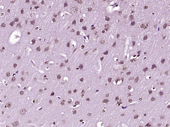 Phospho-FoxO1 (Ser256) Rabbit Polyclonal Antibody