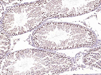 Phospho-FoxO1 (Ser256) Rabbit Polyclonal Antibody