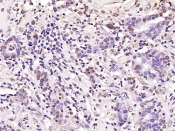 Phospho-FoxO1 (Ser256) Rabbit Polyclonal Antibody