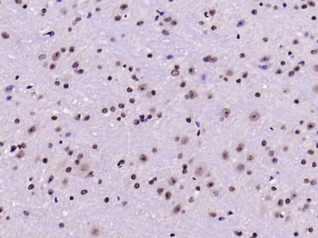 Phospho-FoxO1 (Ser256) Rabbit Polyclonal Antibody