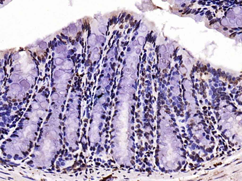 Phospho-FoxO1 (Ser256) Rabbit Polyclonal Antibody
