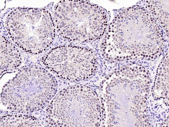 Phospho-FoxO1 (Ser256) Rabbit Polyclonal Antibody