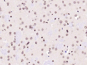 Phospho-FoxO1 (Ser256) Rabbit Polyclonal Antibody