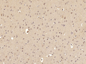 Phospho-FoxO3a (Ser318 + Ser321) Rabbit Polyclonal Antibody