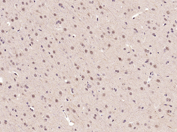 Phospho-FoxO3a (Ser253) Rabbit Polyclonal Antibody