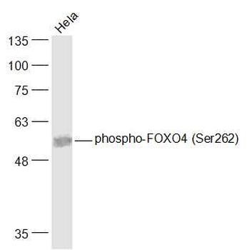 Phospho-FOXO4 (Ser262) Rabbit Polyclonal Antibody