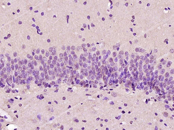 Phospho-FRA1 (Ser265) Rabbit Polyclonal Antibody