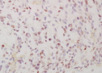 Phospho-FRA1 (Ser265) Rabbit Polyclonal Antibody