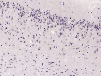 GAB2 Rabbit Polyclonal Antibody