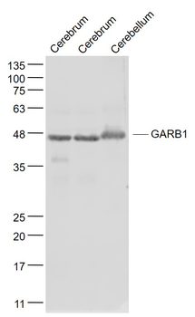 GARB1 Rabbit Polyclonal Antibody