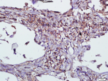 EIF2AK4/GCN2 Rabbit Polyclonal Antibody