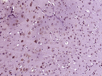 Phospho-GCN2 (Thr667) Rabbit Polyclonal Antibody