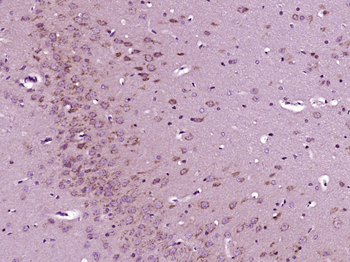 Phospho-GCN2 (Thr667) Rabbit Polyclonal Antibody