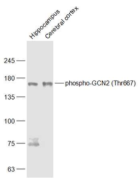 Phospho-GCN2 (Thr667) Rabbit Polyclonal Antibody